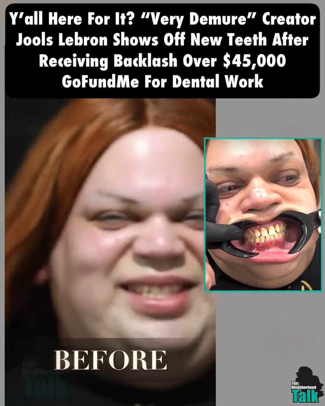 [Monday] Jools Got New Teeth!